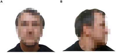 Does presenting perpetrator and innocent suspect faces from different facial angles influence the susceptibility of eyewitness memory? An investigation into the misinformation effect and eyewitness misidentification